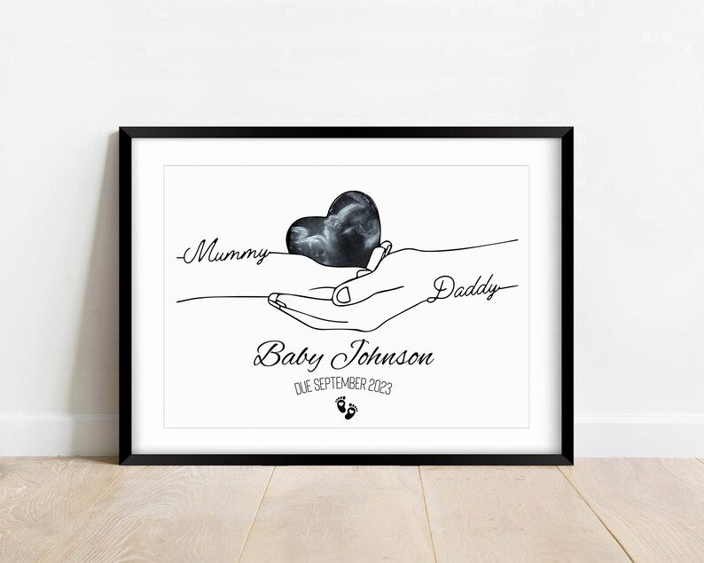 Minimalist Pregnancy Announcement Print, Line Art Baby Scan Poster, First Pregnancy Reveal, Baby Scan Photo Keepsake, Baby Reveal Gift Print